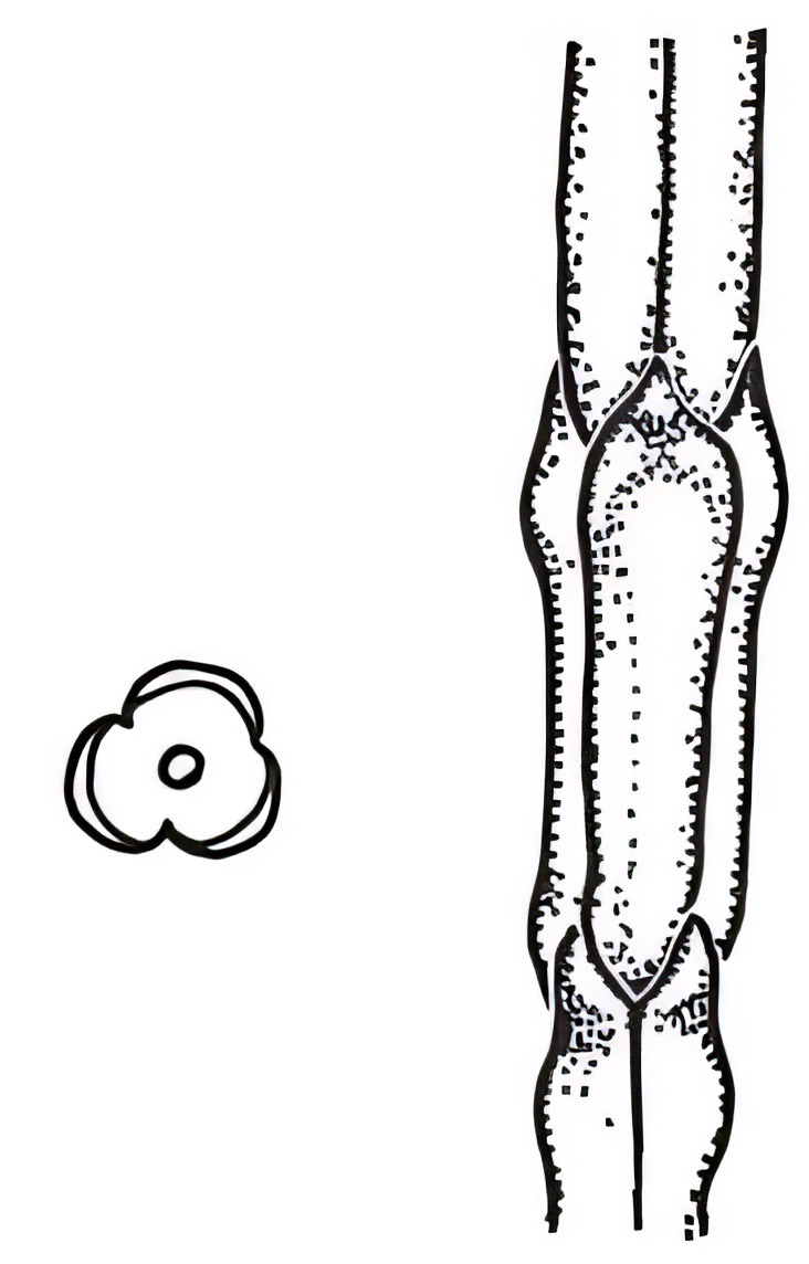 Callitris gracilis