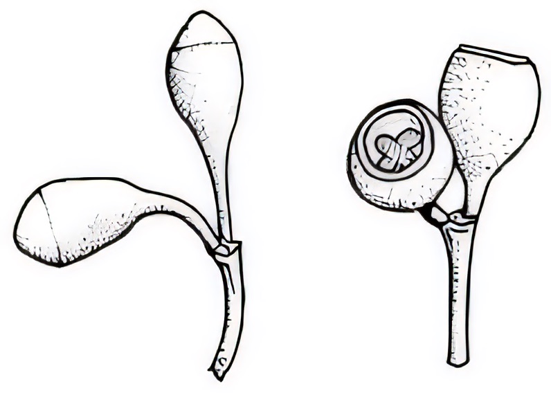 Eucalyptus intertexta